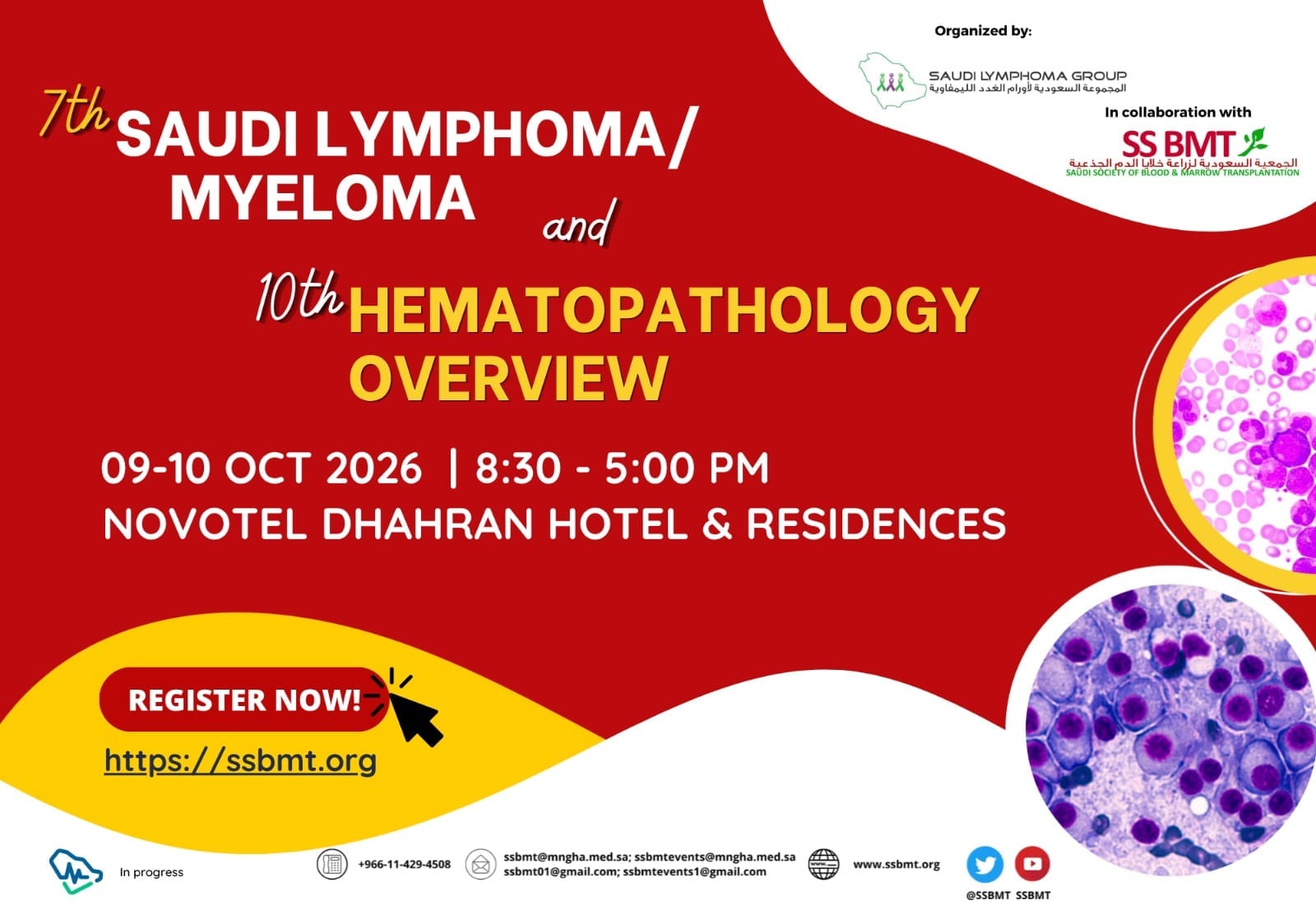 Saudi Society of Blood & Marrow Transplantation (SSBMT)  banner